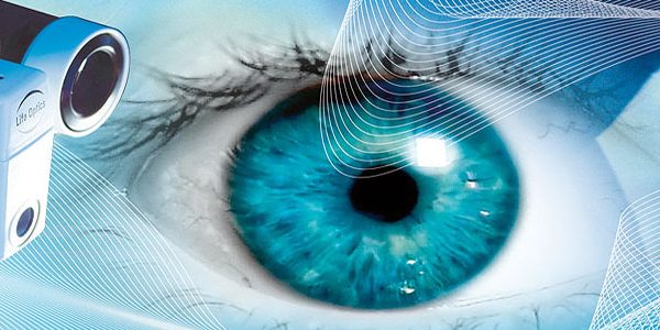 マイクロステッパーモータが画像をはっきりと捉える